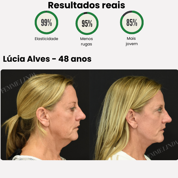 Femme Lifting Roller: Creme de Firmeza, Elasticidade e Juventude para o Pescoço e Rosto