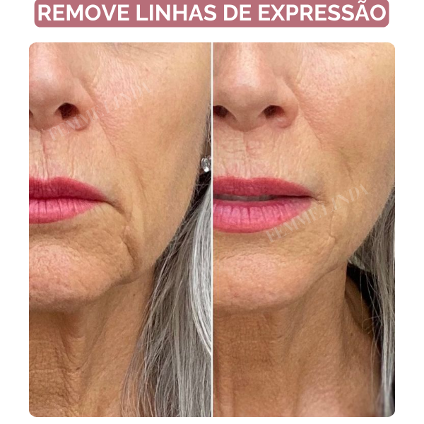 Femme Glow: Esponja Coreana com Remoção de Manchas de Envelhecimento