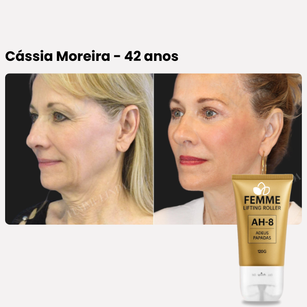 Femme Lifting Roller: Creme de Firmeza, Elasticidade e Juventude para o Pescoço e Rosto
