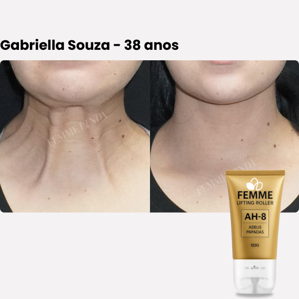 Femme Lifting Roller: Creme de Firmeza, Elasticidade e Juventude para o Pescoço e Rosto