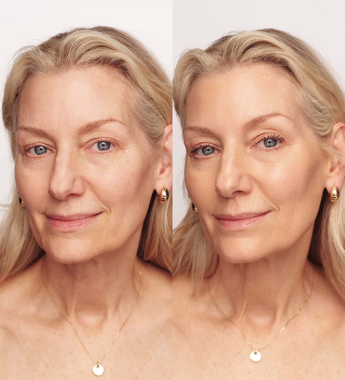 Femme Skin: Aparelho Rejuvenescedor 4 em 1