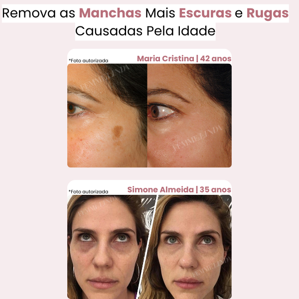 Máscara de Colágeno Aloe Vera: Anti Olheiras e Rugas Efeito Botox