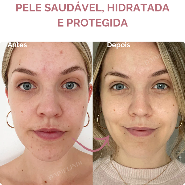 Rose Bastão Solar: Proteção, Hidratação e Controle da Oleosidade - COMPRE 1 E LEVE 2