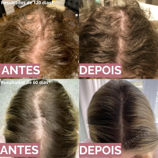 Femme Batana Oil: Creme Para Crescimento Intenso e Natural Dos Fios