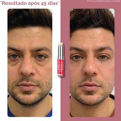 Femme Eye Stick: Bastão Anti-Olheiras e Anti-Idade com Retinol