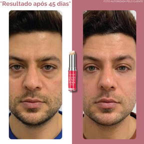 Femme Eye Stick: Bastão Anti-Olheiras e Anti-Idade com Retinol
