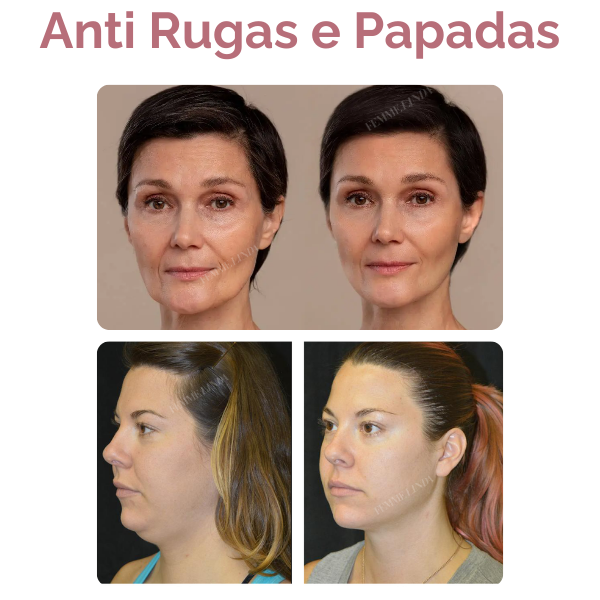 Femme Mask: Máscara de Colágeno e Retinol com Efeito Botox