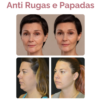 Femme Mask: Máscara de Colágeno e Retinol com Efeito Botox