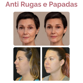 Femme Mask: Máscara de Colágeno e Retinol com Efeito Botox